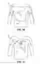 Fig. 03 - Garment with conductive thread exposed on both sides
