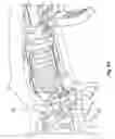 Fig. 08 - Surgical forceps