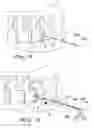 Fig. 08 - INTERVERTEBRAL PROSTHESIS, APPARATUS FOR IMPLANTING INTERVERTEBRAL PROSTHESES AND SURGICAL METHOD FOR IMPLANTING INTERVERTEBRAL PROSTHESES, PARTICULARLY FOR PERCUTANEOUS MINI-INVASIVE SURGERY PROCEDURES
