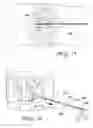 Fig. 09 - INTERVERTEBRAL PROSTHESIS, APPARATUS FOR IMPLANTING INTERVERTEBRAL PROSTHESES AND SURGICAL METHOD FOR IMPLANTING INTERVERTEBRAL PROSTHESES, PARTICULARLY FOR PERCUTANEOUS MINI-INVASIVE SURGERY PROCEDURES