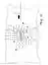 Fig. 28 - INTERVERTEBRAL PROSTHESIS, APPARATUS FOR IMPLANTING INTERVERTEBRAL PROSTHESES AND SURGICAL METHOD FOR IMPLANTING INTERVERTEBRAL PROSTHESES, PARTICULARLY FOR PERCUTANEOUS MINI-INVASIVE SURGERY PROCEDURES