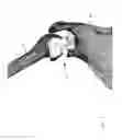 Fig. 02 - PATIENT-SPECIFIC SURGICAL GUIDE