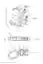 Fig. 05 - Spinal prosthesis with adjustable support element