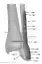 Fig. 01 - Fracture plates, systems, and methods