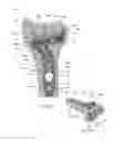 Fig. 02 - Volar distal radius stabilization system