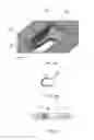 Fig. 09 - Volar distal radius stabilization system