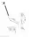 Fig. 02 - Subxiphoid connective lesion ablation system and method