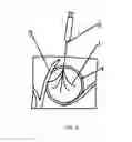 Fig. 05 - CONTROLLED MULTI-NEEDLE POINT EXPANDING RADIOFREQUENCY ABLATION ELECTRODE NEEDLE