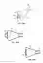 Fig. 22 - Apparatus and Methods for Ablation Efficacy