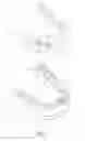 Fig. 02 - Tooth-positioning appliance for closing spaces