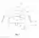 Fig. 07 - Tooth-positioning appliance for closing spaces