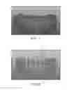 Fig. 07 - DIGITAL FULL ARCH APPARATUS AND METHOD FOR IMMEDIATE DEFINITIVE DENTAL PROSTHESES
