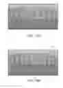 Fig. 09 - DIGITAL FULL ARCH APPARATUS AND METHOD FOR IMMEDIATE DEFINITIVE DENTAL PROSTHESES