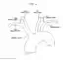 Fig. 05 - Vessel Access Catheter