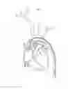 Fig. 08 - Vessel Access Catheter