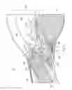 Fig. 02 - Devices, systems, and methods for trabecular meshwork extension
