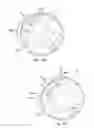 Fig. 09 - Devices, systems, and methods for trabecular meshwork extension