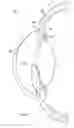 Fig. 02 - Synthetic flap for trabeculectomy procedures