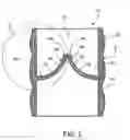 Fig. 03 - Prosthetic heart valve formation