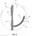 Fig. 08 - Prosthetic heart valve formation