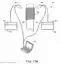 Fig. 16 - Prosthetic heart valve formation