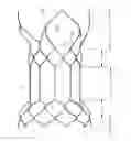 Fig. 01 - Valve stent used safely and valve replacement device having the same