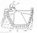 Fig. 01 - Prosthetic heart valve with retention elements