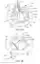 Fig. 02 - Prosthetic heart valve with retention elements