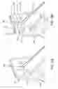 Fig. 06 - Prosthetic heart valve with retention elements