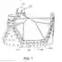 Fig. 08 - Prosthetic heart valve with retention elements