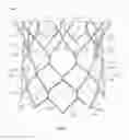 Fig. 02 - SIZING DEVICE AND METHOD OF POSITIONING A PROSTHETIC HEART VALVE
