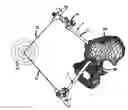 Fig. 01 - Set of instruments for the implantation of an acetabular prosthesis