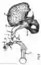 Fig. 06 - Set of instruments for the implantation of an acetabular prosthesis
