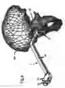 Fig. 09 - Set of instruments for the implantation of an acetabular prosthesis