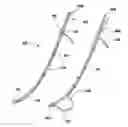 Fig. 01 - Devices and methods for facilitating sleeve gastrectomy procedures