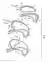 Fig. 02 - Devices and methods for facilitating sleeve gastrectomy procedures