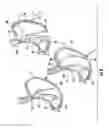 Fig. 04 - Devices and methods for facilitating sleeve gastrectomy procedures