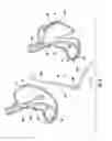 Fig. 06 - Devices and methods for facilitating sleeve gastrectomy procedures