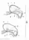 Fig. 10 - Devices and methods for facilitating sleeve gastrectomy procedures