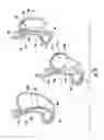Fig. 11 - Devices and methods for facilitating sleeve gastrectomy procedures