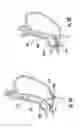 Fig. 21 - Devices and methods for facilitating sleeve gastrectomy procedures