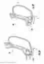 Fig. 22 - Devices and methods for facilitating sleeve gastrectomy procedures