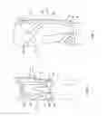 Fig. 02 - Orthopedic device for treating complications of the hip