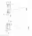 Fig. 05 - Orthopedic device for treating complications of the hip