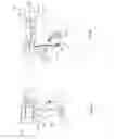 Fig. 07 - Orthopedic device for treating complications of the hip