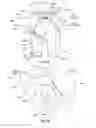 Fig. 09 - Orthopedic device for treating complications of the hip
