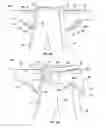 Fig. 14 - Orthopedic device for treating complications of the hip