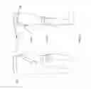 Fig. 22 - Orthopedic device for treating complications of the hip