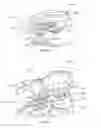 Fig. 26 - Orthopedic device for treating complications of the hip