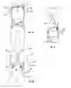 Fig. 34 - Orthopedic device for treating complications of the hip
